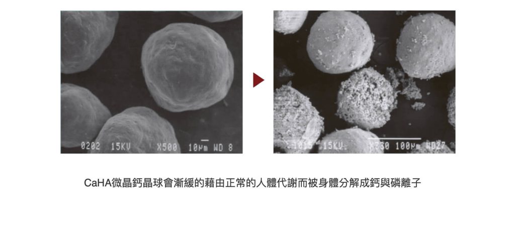 女神微晶瓷 - 東京小野-台中醫美診所推薦