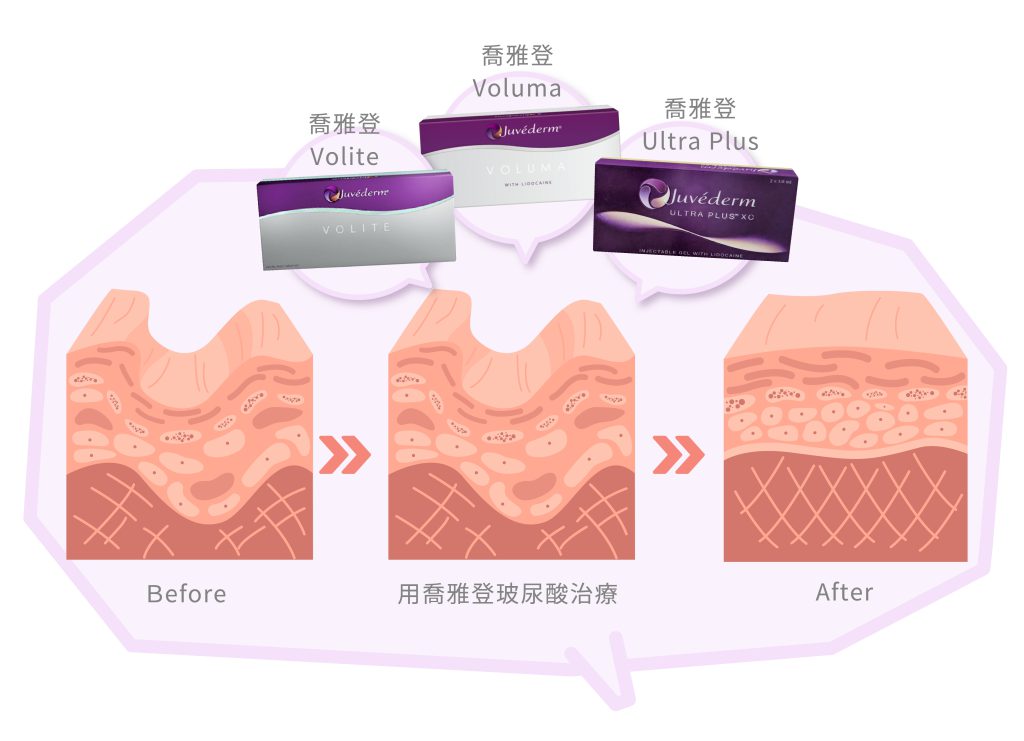 喬雅登 工作區域 1 複本 4