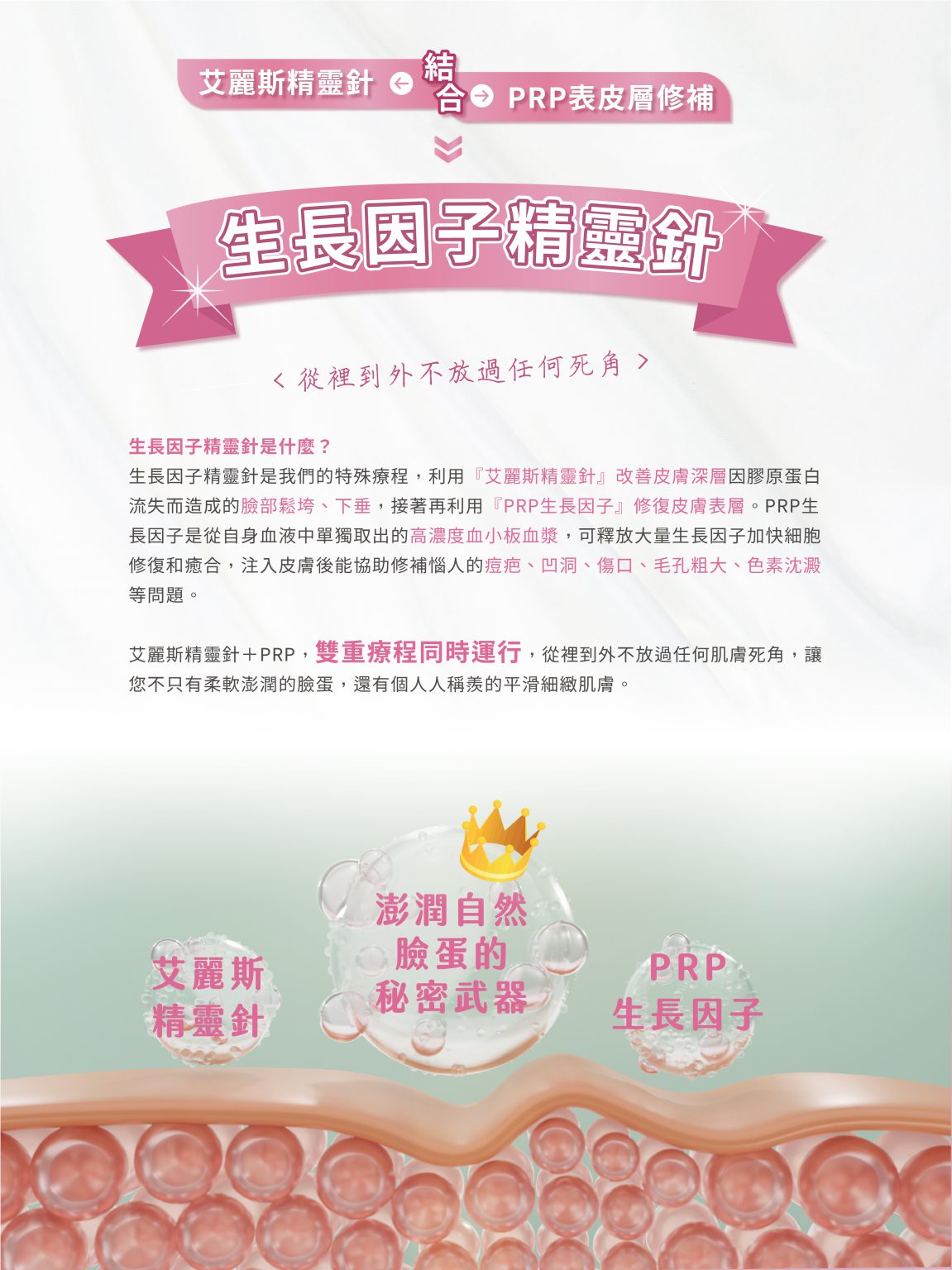 精靈針 工作區域 1 複本 13 工作區域 1 複本 13