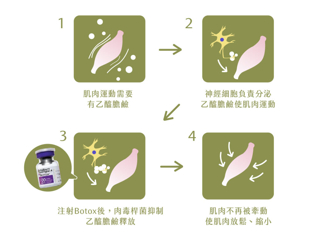 工作區域 1 複本 4 100
