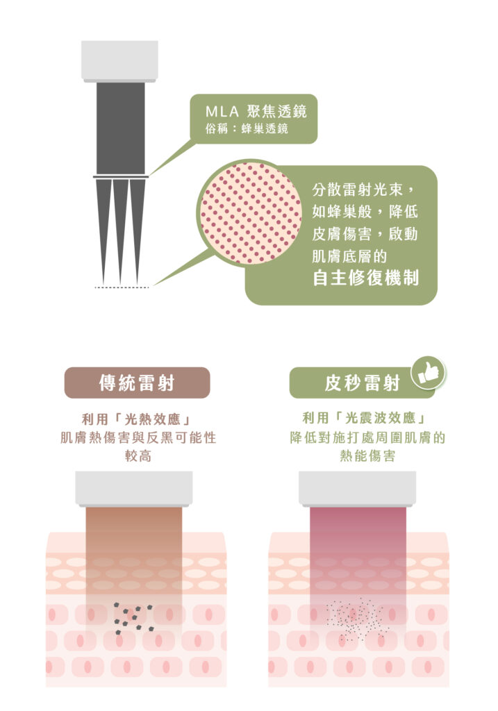 小野 外泌體皮秒雷射 工作區域 1 複本 2
